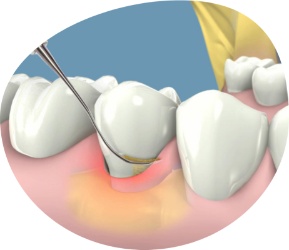 tratamientos dentales en Triana